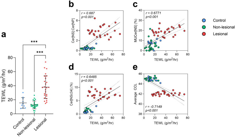 银屑病皮损真相:皮肤角质层神经酰胺图谱全解析